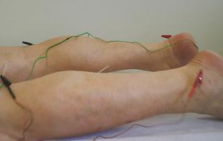 dor na perna esquerda choques culturais