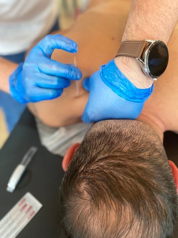 curso dry needling porto